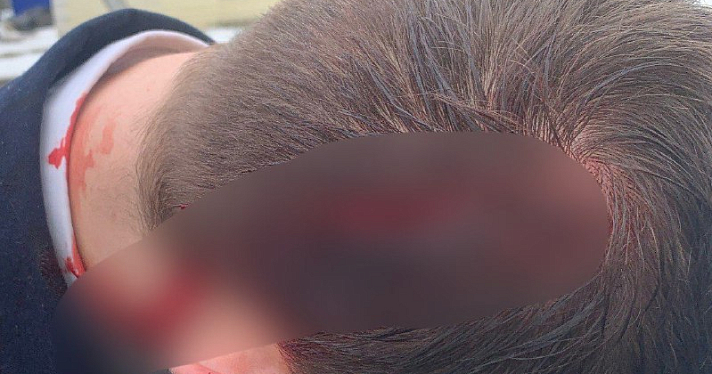 В Рыбинске упавшая глыба льда рассекла голову курсанту