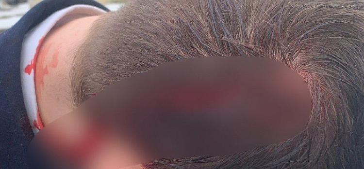 В Рыбинске упавшая глыба льда рассекла голову курсанту