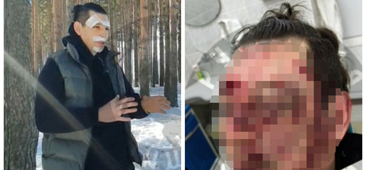 В Ярославской области осудили пятерых хулиганов за драку на сельской дискотеке