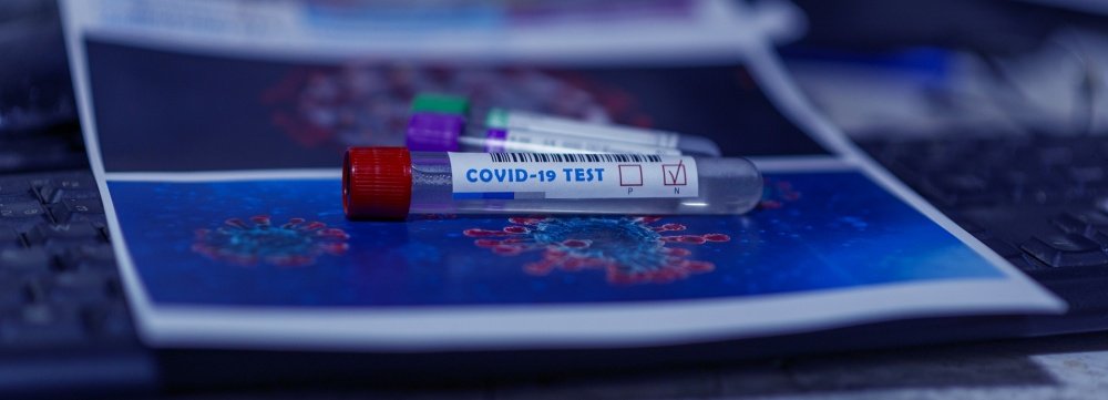 Эксперт — о сроках тестирования на коронавирус в Ярославской области