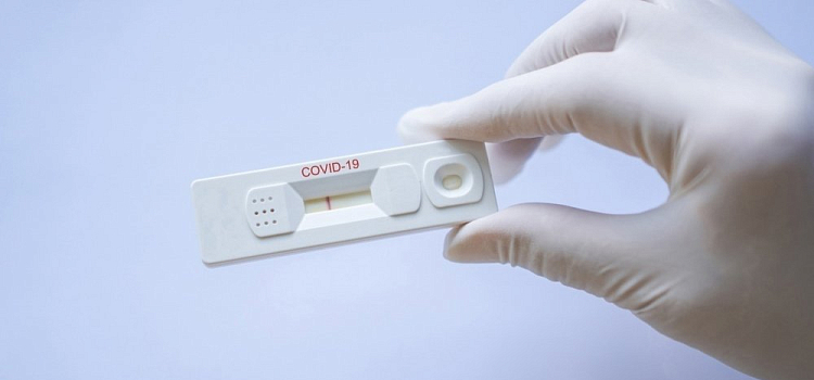 Ярославская область закупит еще 60 тысяч экспресс-тестов на COVID-19