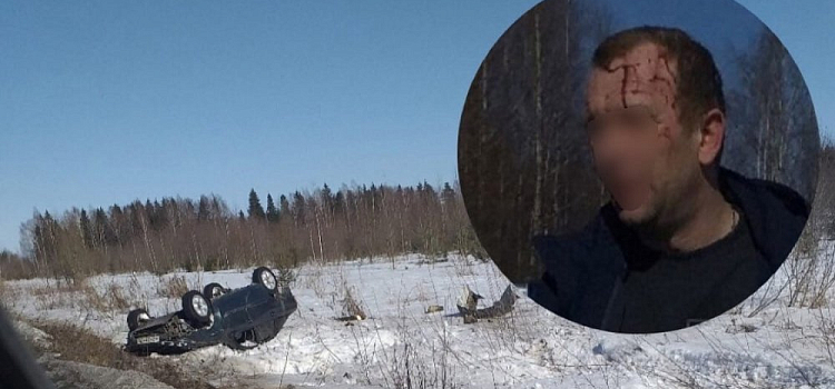 По лицу стекала кровь: травматичное ДТП под Ярославлем