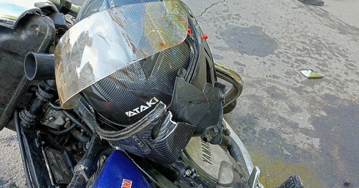 «Ногу пришлось ампутировать»: ярославское мотосообщество объявило сбор средств для байкера, пострадавшего в ДТП