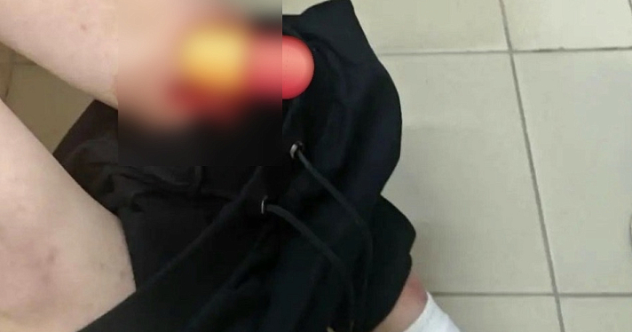 «Швы, гипс, шок»: в селе Ярославской области ребёнок провалился на детской площадке