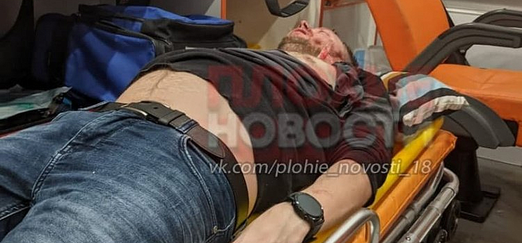 Впал в кому: подробности драки в баре в центре Ярославля