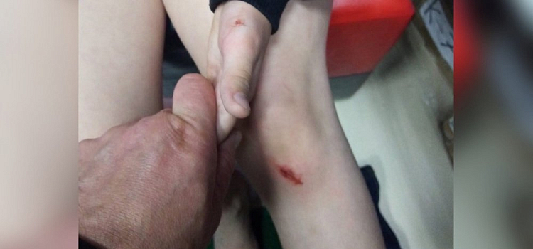 По ноге текла кровь: ярославна рассказала, как ее сын упал в открытый люк 