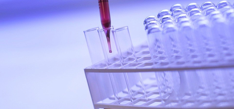 В Ярославской области выявили 107 новых случаев заражения ВИЧ-инфекцией