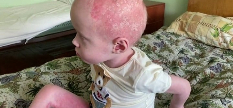 Била сына раскаленной сковородкой: в соцсетях Рыбинска мать обвинили в жестоком обращении с ребенком