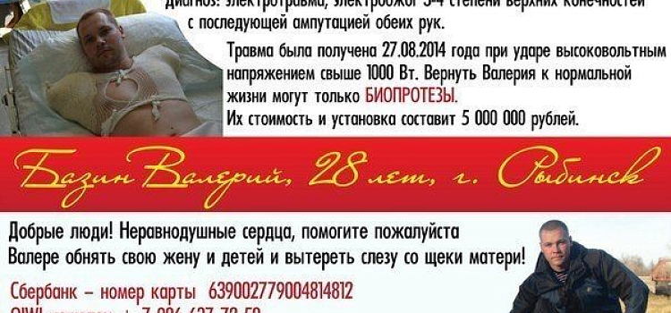 Рыбинцу всем миром собирают деньги на протезы_23533