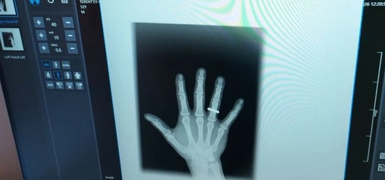 В травмпункте ярославской больницы заработал новый цифровой рентген