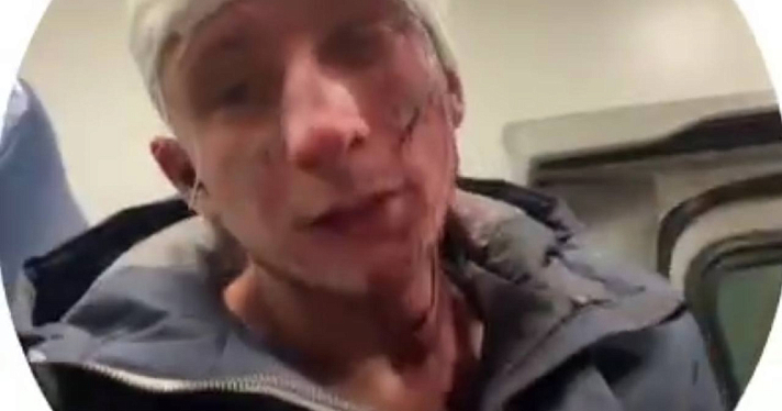 «Избил за донаты»: Екатерина Мизулина рассказала об ещё одном треш-стримере из Ярославля